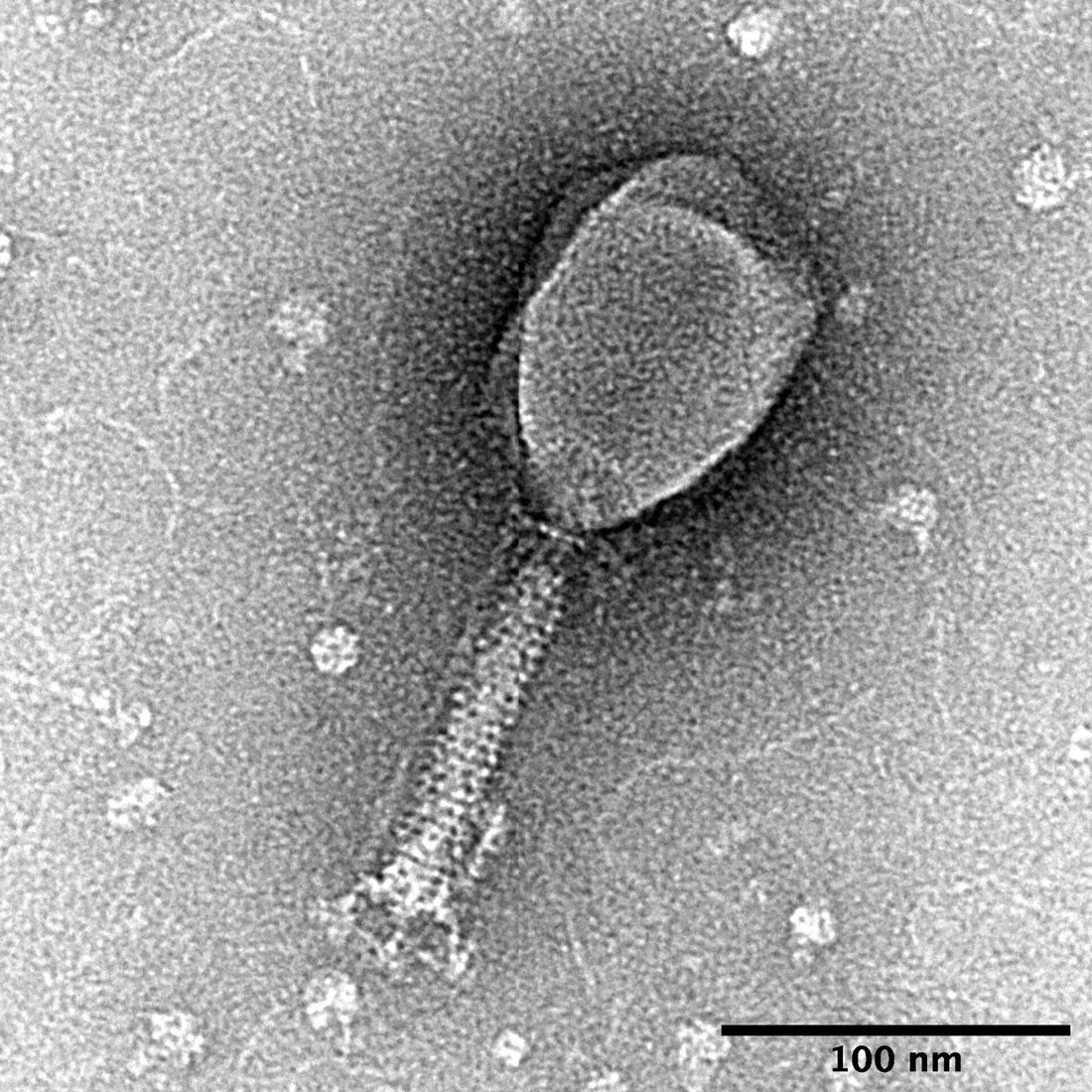 Ces virus qui mangent les bactéries reviennent au chevet des infections résistantes