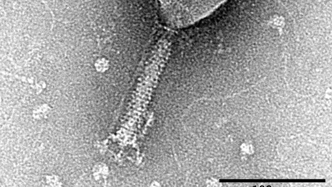Ces virus qui mangent les bactéries reviennent au chevet des infections résistantes