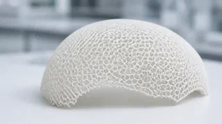 Réparer un crâne d'enfant sans l'empêcher de grandir : la piste des implants qui s'effacent